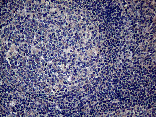 PON3 Antibody - Immunohistochemical staining of paraffin-embedded Human tonsil within the normal limits using anti-PON3 mouse monoclonal antibody. (Heat-induced epitope retrieval by 1mM EDTA in 10mM Tris buffer. (pH8.5) at 120°C for 3 min. (1:2000)