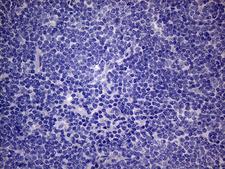 PON3 Antibody - Immunohistochemical staining of paraffin-embedded Human lymphoma tissue using anti-PON3 mouse monoclonal antibody.This figure shows negative staining. (Heat-induced epitope retrieval by 1mM EDTA in 10mM Tris buffer. (pH8.5) at 120°C for 3 min. (1:150)