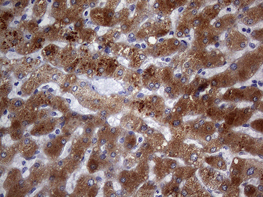 PON3 Antibody - Immunohistochemical staining of paraffin-embedded Human liver tissue within the normal limits using anti-PON3 mouse monoclonal antibody. (Heat-induced epitope retrieval by 1mM EDTA in 10mM Tris buffer. (pH8.5) at 120°C for 3 min. (1:150)