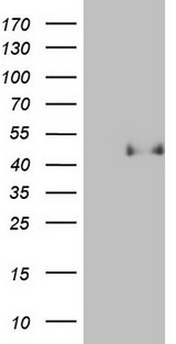 PON3 Antibody - HEK293T cells were transfected with the pCMV6-ENTRY control (Left lane) or pCMV6-ENTRY PON3 (Right lane) cDNA for 48 hrs and lysed. Equivalent amounts of cell lysates (5 ug per lane) were separated by SDS-PAGE and immunoblotted with anti-PON3.