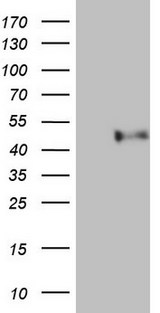 PON3 Antibody - HEK293T cells were transfected with the pCMV6-ENTRY control. (Left lane) or pCMV6-ENTRY PON3. (Right lane) cDNA for 48 hrs and lysed. Equivalent amounts of cell lysates. (5 ug per lane) were separated by SDS-PAGE and immunoblotted with anti-PON3.