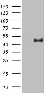 PON3 Antibody - HEK293T cells were transfected with the pCMV6-ENTRY control. (Left lane) or pCMV6-ENTRY PON3. (Right lane) cDNA for 48 hrs and lysed. Equivalent amounts of cell lysates. (5 ug per lane) were separated by SDS-PAGE and immunoblotted with anti-PON3.