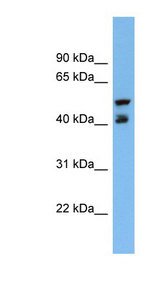 PON3 Antibody - PON3 antibody Western blot of NCI-H226 cell lysate. This image was taken for the unconjugated form of this product. Other forms have not been tested.
