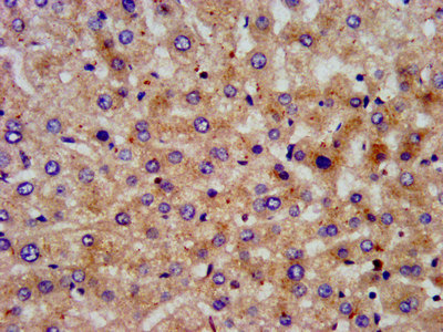 PON3 Antibody - Immunohistochemistry image at a dilution of 1:200 and staining in paraffin-embedded human liver tissue performed on a Leica BondTM system. After dewaxing and hydration, antigen retrieval was mediated by high pressure in a citrate buffer (pH 6.0) . Section was blocked with 10% normal goat serum 30min at RT. Then primary antibody (1% BSA) was incubated at 4 °C overnight. The primary is detected by a biotinylated secondary antibody and visualized using an HRP conjugated SP system.