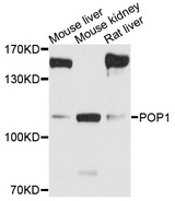 POP1 Antibody - Western blot analysis of extracts of various cells.