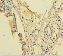POP4 Antibody - Immunohistochemistry of paraffin-embedded human lung tissue using POP4 Antibody at dilution of 1:100