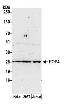 POP4 Antibody - Detection of human POP4 by western blot. Samples: Whole cell lysate (50 µg) from HeLa, HEK293T, and Jurkat cells prepared using NETN lysis buffer. Antibody: Affinity purified rabbit anti-POP4 antibody used for WB at 1:1000. Detection: Chemiluminescence with an exposure time of 3 minutes.