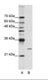 POP4 Antibody - A: Marker, B: HepG2 Cell Lysate.  This image was taken for the unconjugated form of this product. Other forms have not been tested.