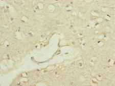 POP4 Antibody - Immunohistochemistry of paraffin-embedded human brain tissue at dilution of 1:100
