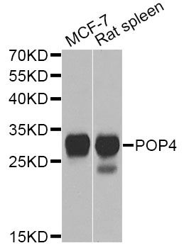 POP4 Antibody - Western blot analysis of extracts of various cell lines, using POP4 Antibody at 1:1000 dilution. The secondary antibody used was an HRP Goat Anti-Rabbit IgG (H+L) at 1:10000 dilution. Lysates were loaded 25ug per lane and 3% nonfat dry milk in TBST was used for blocking. An ECL Kit was used for detection and the exposure time was 90s.