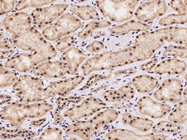 POP4 Antibody - Immunochemical staining of human POP4 in human kidney with rabbit polyclonal antibody at 1:100 dilution, formalin-fixed paraffin embedded sections.