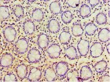 POP7 Antibody - Immunohistochemistry of paraffin-embedded human rectum tissue using antibody at 1:100 dilution.