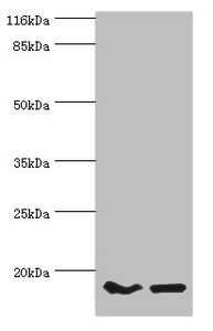 POP7 Antibody - Western blot All lanes: POP7 antibody at 10µg/ml Lane 1: Hela whole cell lysate Lane 2: HepG2 whole cell lysate Secondary Goat polyclonal to rabbit IgG at 1/10000 dilution Predicted band size: 16 kDa Observed band size: 16 kDa