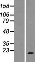 POP7 Protein - Western validation with an anti-DDK antibody * L: Control HEK293 lysate R: Over-expression lysate