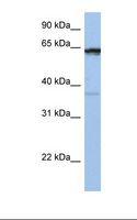 POPDC2 Antibody - Jurkat cell lysate. Antibody concentration: 1.0 ug/ml. Gel concentration: 12%.  This image was taken for the unconjugated form of this product. Other forms have not been tested.