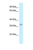 POPDC3 Antibody - POPDC3 antibody Western blot of Mouse Liver lysate. Antibody concentration 1 ug/ml.  This image was taken for the unconjugated form of this product. Other forms have not been tested.