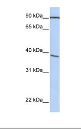 POPDC3 Antibody - HepG2 cell lysate. Antibody concentration: 1.0 ug/ml. Gel concentration: 12%.  This image was taken for the unconjugated form of this product. Other forms have not been tested.