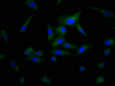POPDC3 Antibody - Immunofluorescence staining of Hela cells at a dilution of 1:200, counter-stained with DAPI. The cells were fixed in 4% formaldehyde, permeabilized using 0.2% Triton X-100 and blocked in 10% normal Goat Serum. The cells were then incubated with the antibody overnight at 4 °C.The secondary antibody was Alexa Fluor 488-congugated AffiniPure Goat Anti-Rabbit IgG (H+L) .