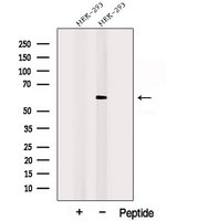 POPDC3 Antibody - Western blot analysis of extracts of HEK293 cells using POPDC3 antibody. The lane on the left was treated with blocking peptide.