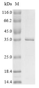 NS1 Protein - (Tris-Glycine gel) Discontinuous SDS-PAGE (reduced) with 5% enrichment gel and 15% separation gel.