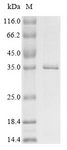 NS1 Protein - (Tris-Glycine gel) Discontinuous SDS-PAGE (reduced) with 5% enrichment gel and 15% separation gel.