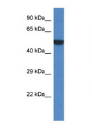 PORCN Antibody - PORCN antibody Western blot of Mouse Thymus lysate. Antibody concentration 1 ug/ml.  This image was taken for the unconjugated form of this product. Other forms have not been tested.