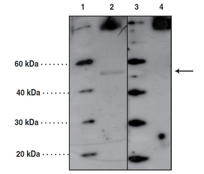 PORCN Antibody - Western blot with PORCN antibody at 4 ug/ml. Lanes 1 and 3: MW markers, Lane 2: A549 cell lysate (20 ug), Lane 4: A549 cell lysate (20 ug) + PORCN peptide (20 ug/ml).