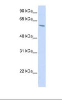 PORCN Antibody - HepG2 cell lysate. Antibody concentration: 1.0 ug/ml. Gel concentration: 12%.  This image was taken for the unconjugated form of this product. Other forms have not been tested.