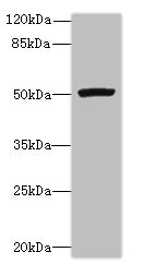 PORCN Antibody - Western blot All lanes: PORCN antibody at 3µg/ml + Mouse thymus tissue Secondary Goat polyclonal to rabbit IgG at 1/10000 dilution Predicted band size: 53, 52, 43 kDa Observed band size: 53 kDa