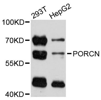 PORCN Antibody - Western blot analysis of extracts of various cell lines, using PORCN antibody at 1:3000 dilution. The secondary antibody used was an HRP Goat Anti-Rabbit IgG (H+L) at 1:10000 dilution. Lysates were loaded 25ug per lane and 3% nonfat dry milk in TBST was used for blocking. An ECL Kit was used for detection and the exposure time was 60s.