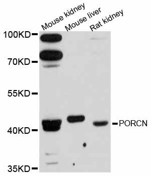 PORCN Antibody - Western blot analysis of extracts of various cell lines, using PORCN antibody at 1:3000 dilution. The secondary antibody used was an HRP Goat Anti-Rabbit IgG (H+L) at 1:10000 dilution. Lysates were loaded 25ug per lane and 3% nonfat dry milk in TBST was used for blocking. An ECL Kit was used for detection and the exposure time was 90s.