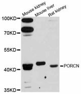 PORCN Antibody - Western blot analysis of extracts of various cell lines, using PORCN antibody at 1:3000 dilution. The secondary antibody used was an HRP Goat Anti-Rabbit IgG (H+L) at 1:10000 dilution. Lysates were loaded 25ug per lane and 3% nonfat dry milk in TBST was used for blocking. An ECL Kit was used for detection and the exposure time was 90s.