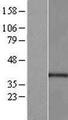 PORCN Protein - Western validation with an anti-DDK antibody * L: Control HEK293 lysate R: Over-expression lysate