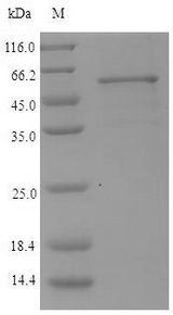 kgp Protein - (Tris-Glycine gel) Discontinuous SDS-PAGE (reduced) with 5% enrichment gel and 15% separation gel.