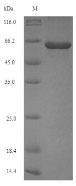 Peptidylarginine Deiminase Protein - (Tris-Glycine gel) Discontinuous SDS-PAGE (reduced) with 5% enrichment gel and 15% separation gel.