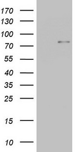 POSTN / Periostin Antibody - HEK293T cells were transfected with the pCMV6-ENTRY control (Left lane) or pCMV6-ENTRY POSTN (Right lane) cDNA for 48 hrs and lysed. Equivalent amounts of cell lysates (5 ug per lane) were separated by SDS-PAGE and immunoblotted with anti-POSTN.