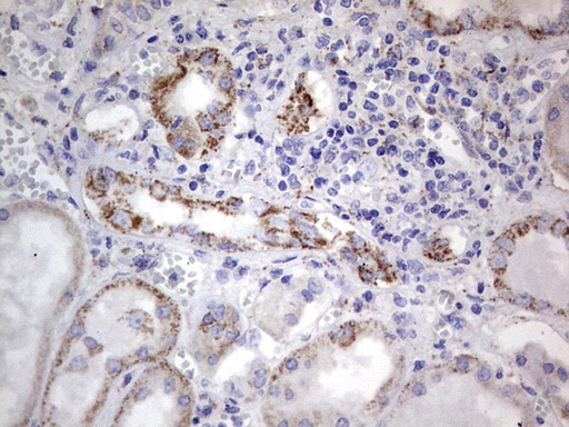POSTN / Periostin Antibody - IHC of paraffin-embedded Human Kidney tissue using anti-POSTN mouse monoclonal antibody. (Heat-induced epitope retrieval by 1 mM EDTA in 10mM Tris, pH8.5, 120°C for 3min).
