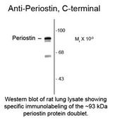 POSTN / Periostin Antibody
