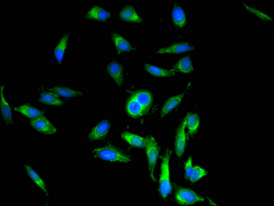 POSTN / Periostin Antibody - Immunofluorescent analysis of Hela cells using POSTN Antibody at dilution of 1:100 and Alexa Fluor 488-congugated AffiniPure Goat Anti-Rabbit IgG(H+L)