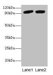 POSTN / Periostin Antibody - Western blot All lanes: Periostin antibody at 2µg/ml Lane 1: Mouse liver tissue Lane 2: Hela whole cell lysate Secondary Goat polyclonal to rabbit IgG at 1/10000 dilution Predicted band size: 94, 88, 84, 91, 81 kDa Observed band size: 94 kDa