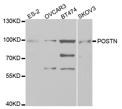 POSTN / Periostin Antibody - Western blot analysis of extracts of various cell lines.
