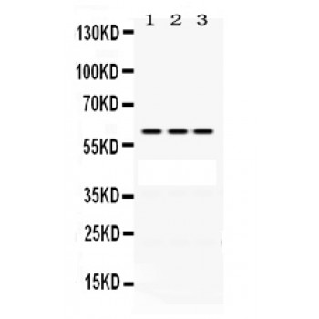 POT1 Antibody - POT1 antibody Western blot. All lanes: Anti POT1 at 0.5 ug/ml. Lane 1: A431 Whole Cell Lysate at 40 ug. Lane 2: HELA Whole Cell Lysate at 40 ug. Lane 3: A549 Whole Cell Lysate at 40 ug. Predicted band size: 60 kD. Observed band size: 60 kD.