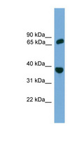 POT1 Antibody - POT1 antibody Western blot of THP-1 cell lysate. This image was taken for the unconjugated form of this product. Other forms have not been tested.