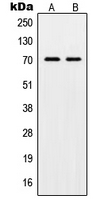POT1 Antibody - Western blot analysis of POT1 expression in HL60 (A); HeLa (B) whole cell lysates.