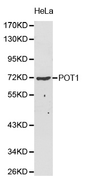 POT1 Antibody - Western blot analysis of HeLa cell lysate.