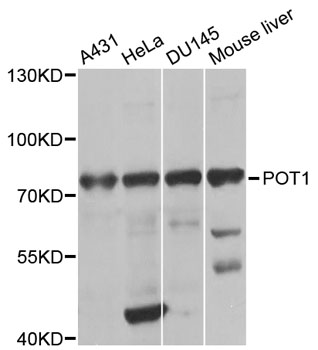 POT1 Antibody - Western blot analysis of extracts of various cell lines, using POT1 antibody at 1:1000 dilution. The secondary antibody used was an HRP Goat Anti-Rabbit IgG (H+L) at 1:10000 dilution. Lysates were loaded 25ug per lane and 3% nonfat dry milk in TBST was used for blocking. An ECL Kit was used for detection and the exposure time was 30s.