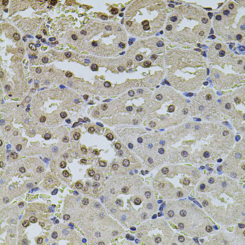 POT1 Antibody - Immunohistochemistry of paraffin-embedded rat kidney using POT1 antibodyat dilution of 1:100 (40x lens).