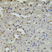POT1 Antibody - Immunohistochemistry of paraffin-embedded rat kidney using POT1 antibodyat dilution of 1:100 (40x lens).