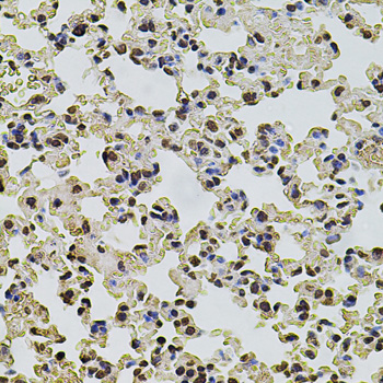 POT1 Antibody - Immunohistochemistry of paraffin-embedded mouse lung using POT1 antibodyat dilution of 1:100 (40x lens).