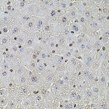 POT1 Antibody - Immunohistochemistry of paraffin-embedded mouse liver using POT1 antibodyat dilution of 1:100 (40x lens).